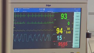 ICU monitor screen displaying patient data. Patient name is Bett, Christian. Time is 11:18, date is 03-Dec-2025. Heart rate is 93, SpO2 is 94, blood pressure is 95/65.