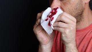 Ein Mann mit einem Ring an seiner linken Hand hält ein Taschentuch mit roten Flecken in der Nähe seiner Nase.
