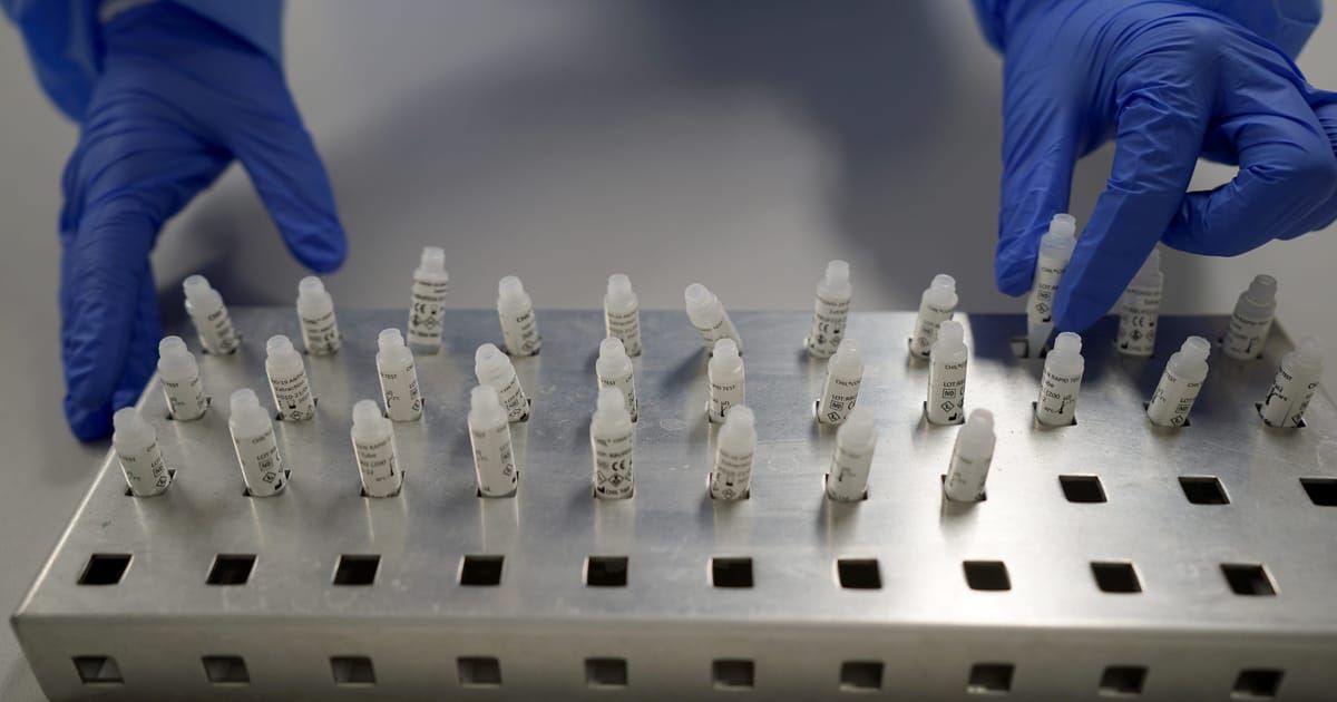 Eine Person in Handschuhen, die kleine weiße Fläschchen auf einem Metalltablett handhabt. Jedes Fläschchen ist mit einer Nummer und einem kleinen Barcode versehen.