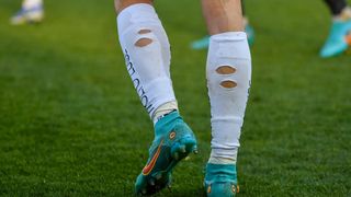 Close-up view of a soccer player's legs with blue cleats and white shin guards with holes.