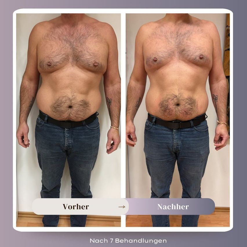 Ein Mann vor und nach einer Behandlung, trägt Jeans und einen schwarzen Gürtel. Der Text zeigt 'Vorher' links und 'Nachher' rechts. Der untere Text lautet 'Nach 7 Behandlungen.'