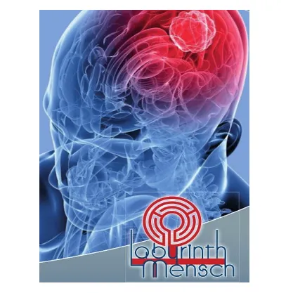 Ein Bild eines menschlichen Gehirns zeigt einen roten Tumor mit einem roten Labyrinth-Logo darunter.
