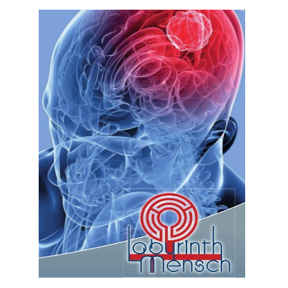 Ein Bild eines menschlichen Gehirns zeigt einen roten Tumor mit einem roten Labyrinth-Logo darunter.