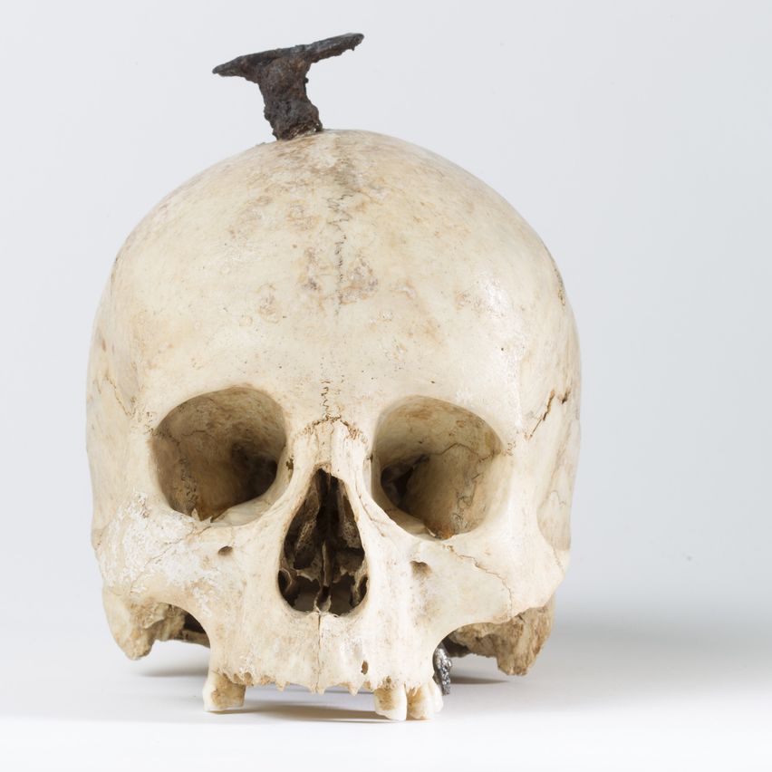 Ein alter menschlicher Schädel mit einem verrosteten Metallobjekt auf der Oberseite, auf einem weißen Hintergrund ausgestellt.