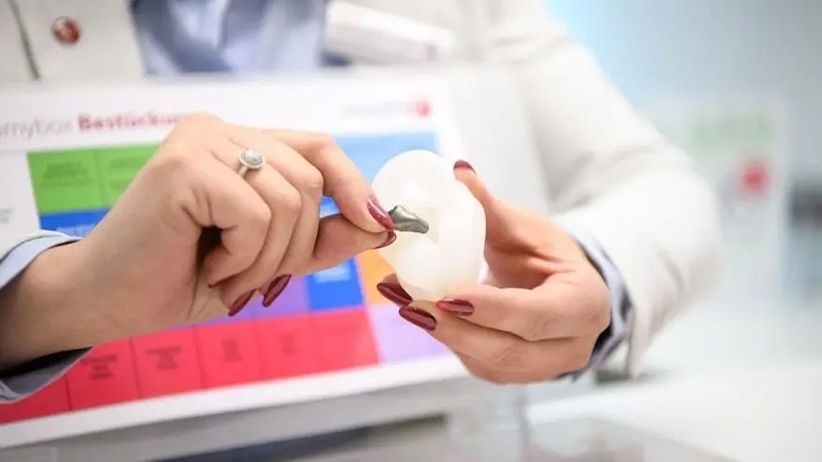 Eine Person in einem weißen Kittel untersucht eine Zahnform und hält ein Werkzeug in der Hand, wahrscheinlich in einer Zahnarztpraxis.