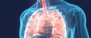 Bild enthält, X-Ray, Person