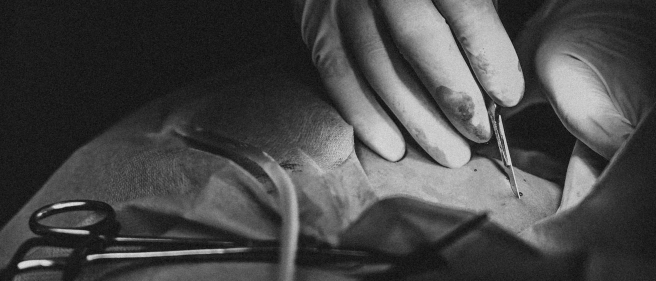 Ein Nahaufnahme einer Hand in Handschuhen, die einen Skalpell hält, führt eine chirurgische Prozedur mit chirurgischen Instrumenten auf einem weißen Tuch durch.