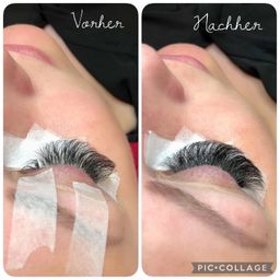 Zwei Bilder von den Wimpern einer Person vor und nach dem Eingriff. Das erste Bild zeigt Wimpern mit Klebeband, das zweite Bild zeigt Wimpern ohne Klebeband.