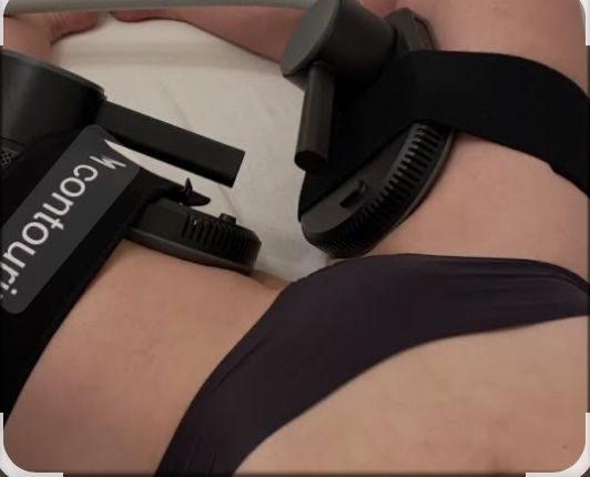 Eine Person liegt auf einem Bett mit schwarzen Gurten um die Hüften und den unteren Rücken, die mit einem Gerät mit der Aufschrift 'counter' verbunden sind. Sie trägt schwarze Unterwäsche.