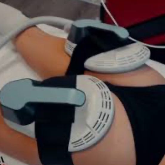 Eine Person liegt auf einem Bett mit medizinischen Elektroden an den Beinen und am Bauch, die mit einem Gerät verbunden sind.