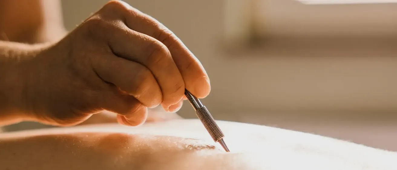 Bild zur Akupunktmassage nach Penzel
