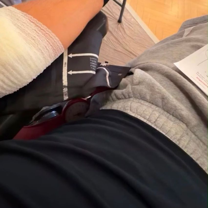 An injured person's leg is bandaged, resting on a chair. Nearby, a medical device is placed on the leg, and a medical note is partially visible.