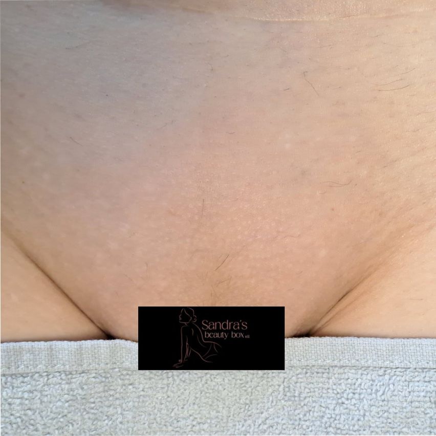 Eine Nahaufnahme der Haut einer Frau, die eine glatte und leicht rosafarbene Textur zeigt. Es sind einige feine Linien und kleinere Unvollkommenheiten sichtbar. Das Bild enthält ein kleines Wasserzeichen mit dem Text 'Sandra's Beauty Box' in der unteren Mitte.