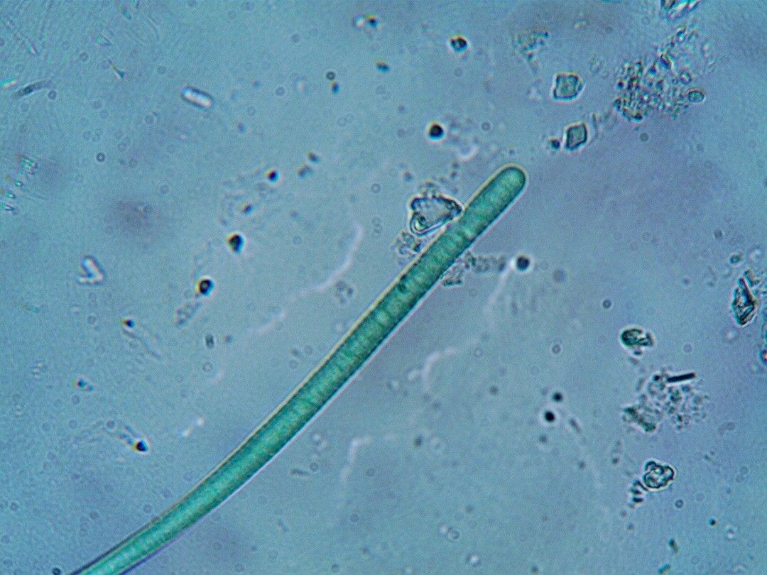 Eine mikroskopische Ansicht eines grünen filamentösen Organismus, möglicherweise eine Art von Alge, die in einem blauen flüssigen Medium schwimmt.