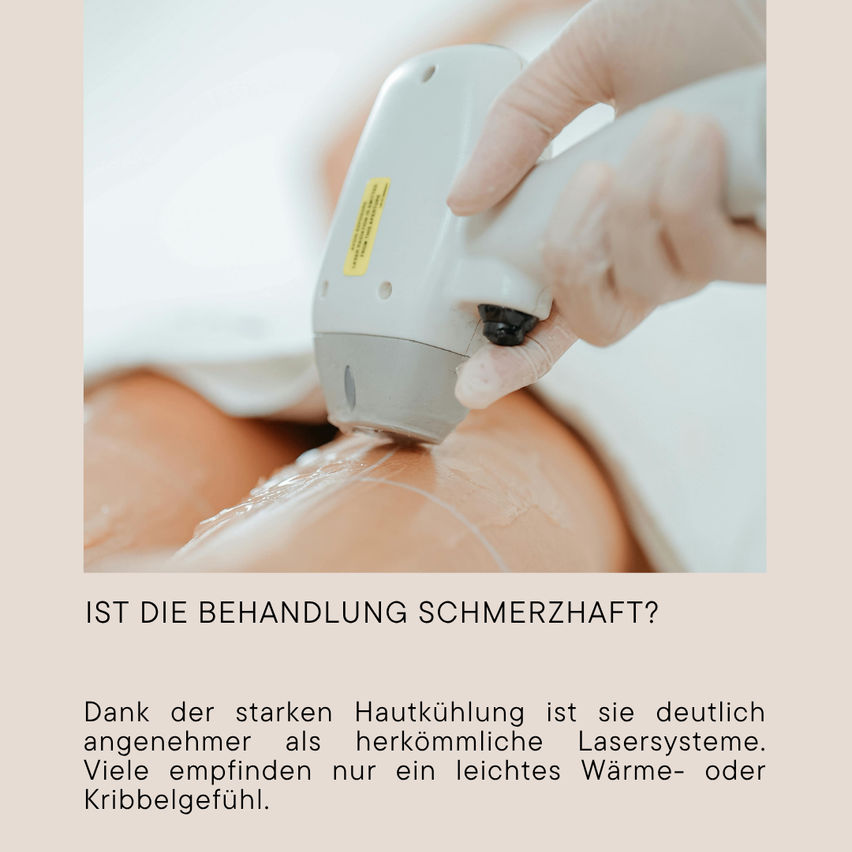 A hand holds a cooling device over a person's skin, likely during a laser treatment. The skin appears smooth with a slight sheen.