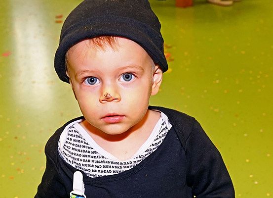 Ein junger Junge mit einem Verband auf der Nase, trägt eine schwarze Mütze und ein schwarzes T-Shirt mit weißem Text. Er sieht etwas traurig aus.