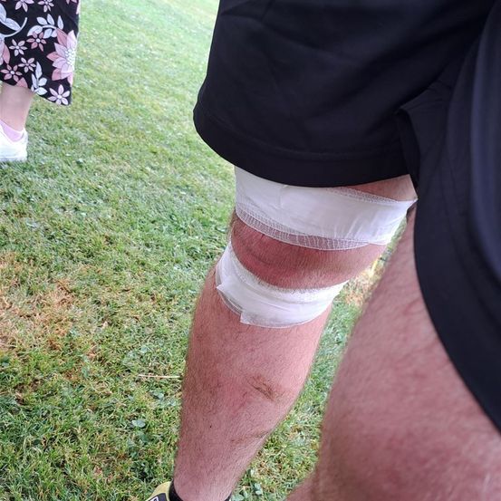 Bild enthält, Body Part, Knee, Person, Skin, Grass, Plant, Clothing, Footwear, Shoe