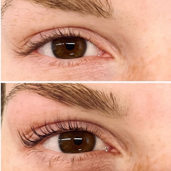Zwei Nahaufnahmen von Augen eines Menschen zeigen einen deutlichen Unterschied in der Wimpernfülle vor und nach einer Behandlung. Das obere Bild zeigt spärliche Wimpern, während das untere Bild deutlich vollere und besser definierte Wimpern zeigt.