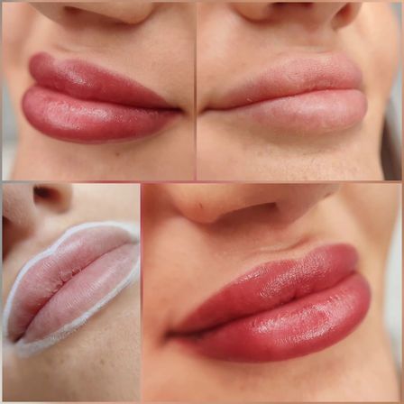 Ein Nahaufnahme-Collage von Frauenlippen vor und nach einer Lippenvergrößerungsbehandlung, die das Auftragen von Lippenfüller und das Endergebnis zeigt.