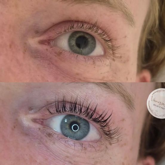 Vor-und Nachbild eines Frauenauges mit deutlicher Verbesserung der Wimpernlänge und -fülle.