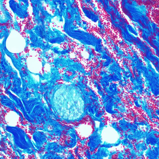 Bild enthält, Rock, Purple