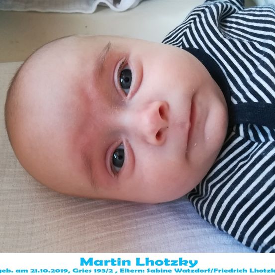 Ein Babyjunge mit kahlem Kopf und blauen Augen liegt auf einer weißen Oberfläche. Er trägt ein schwarz-weiß gestreiftes Hemd. Das Bild hat einen Wasserzeichen mit dem Text Martin Lhotzky unten.