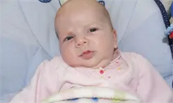Ein Baby mit kahlem Kopf liegt in einem blauen Stuhl, trägt ein rosa Shirt mit roten Punkten und schaut mit leicht geöffnetem Mund zur Kamera.