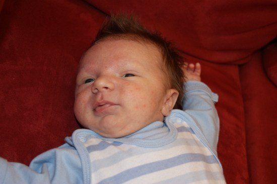 Ein Baby mit einigen Sommersprossen liegt auf einer roten Decke und trägt einen blau-weiß gestreiften Strampler.