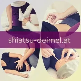 Adult, Female, Person, Woman, Patient, Arm, Body Part, Therapy, Knee