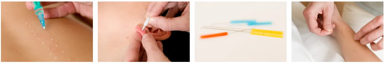 Eine Hand sticht eine Nadel in das Ohr einer Person. Mehrere Nadeln liegen auf einer weißen Oberfläche.