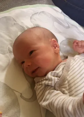 Ein lächelndes Baby mit kahlem Kopf liegt auf einem Bett mit gemusterter Decke. Das Baby trägt einen gestreiften Strampler.